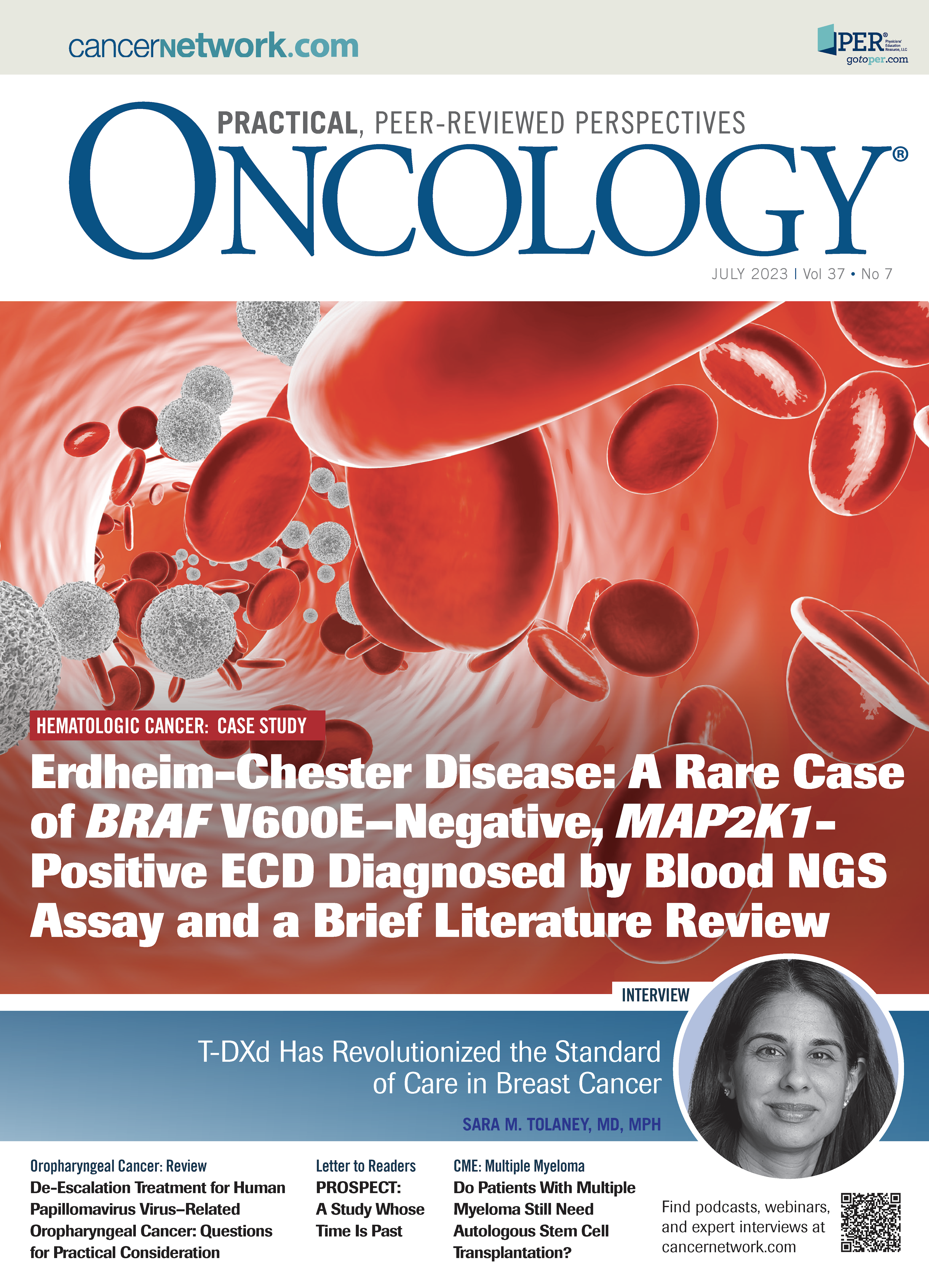 ONCOLOGY Vol 37, Issue 7