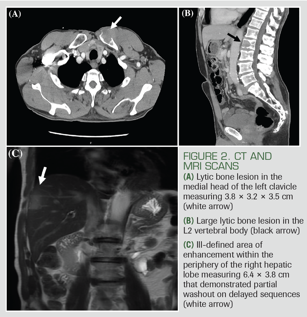 FIGURE 2. CT AND MRI SCANS